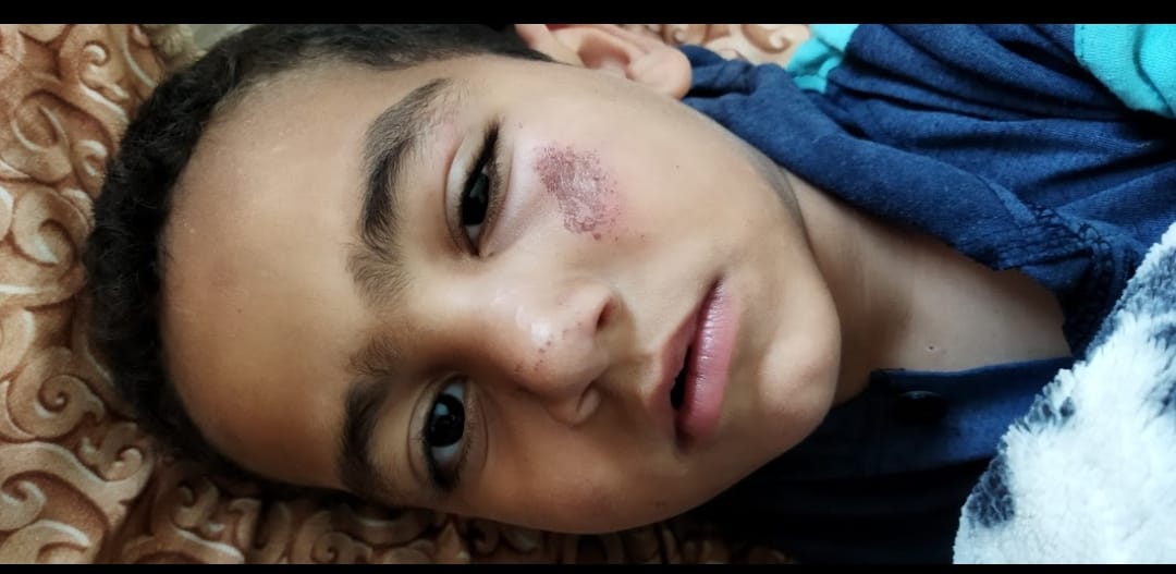One of Afnan's children showing injuries
