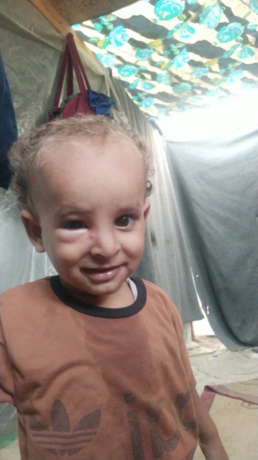 Young child in difficult living conditions